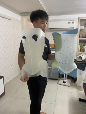  điều trị cong vẹo cột sống, Con phải mặc một hay hai áo nẹp?