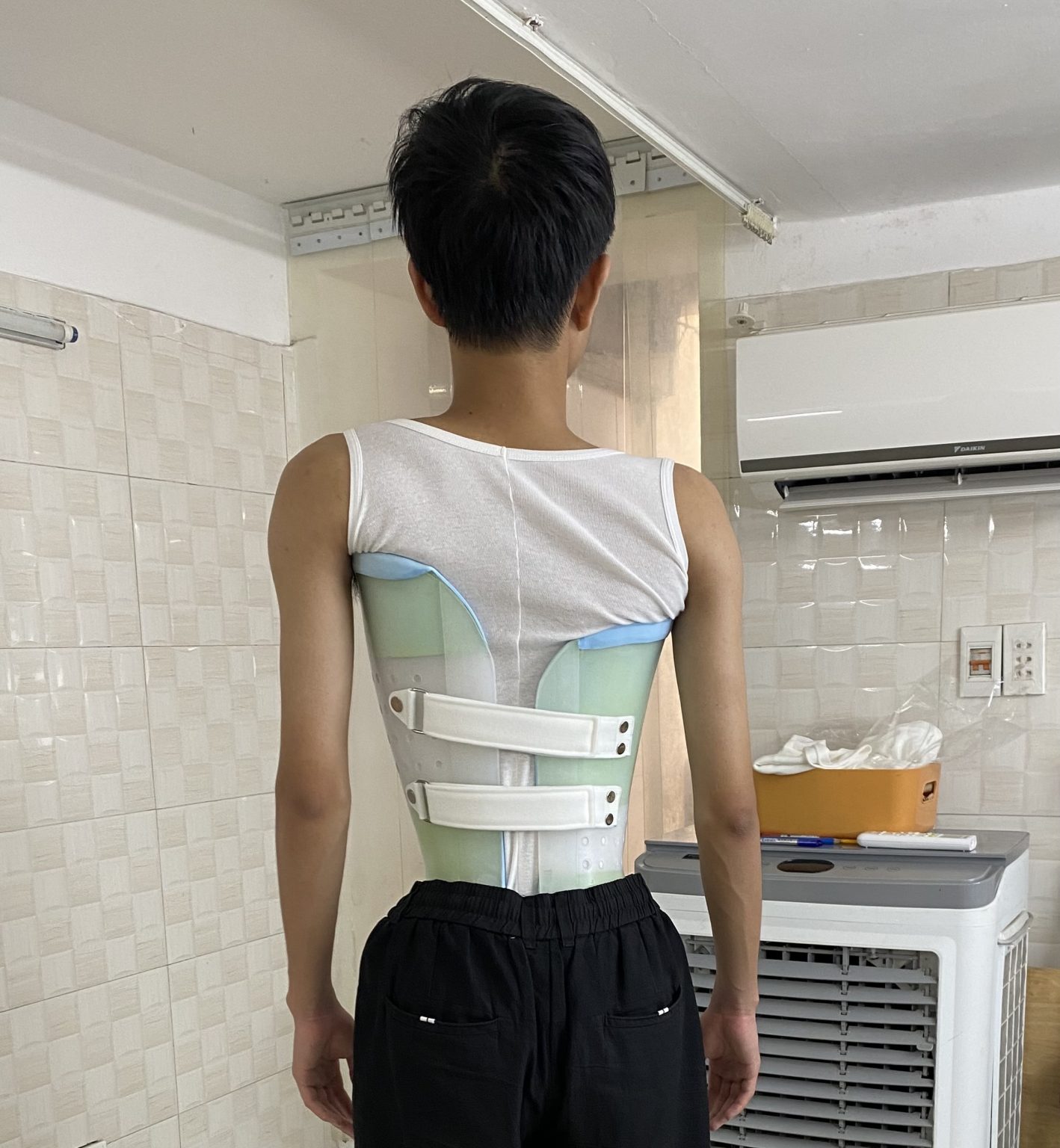 nẹp chỉnh vẹo cột sống