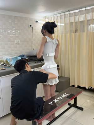Nẹp chỉnh hình cong vẹo cột sống -BN nữ 35 độ cobb